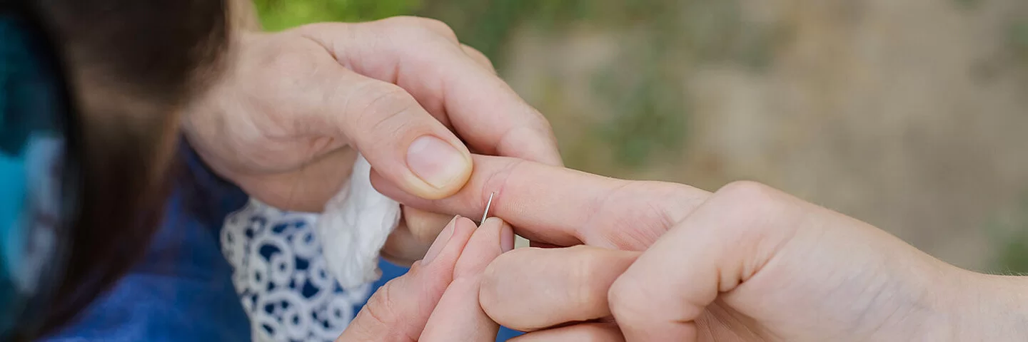 Eine Person entfernt mithilfe einer Nadel bei einem anderen Menschen einen Splitter aus dem rechten Zeigefinger.