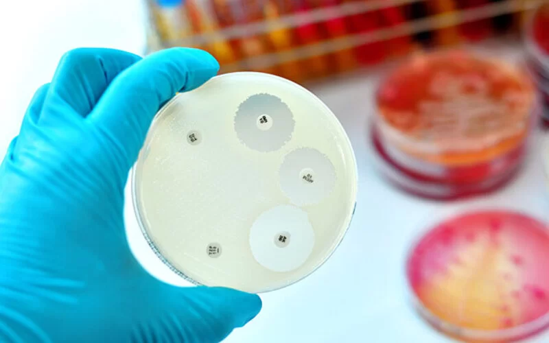 Eine Person im Labor hält eine Petrischale mit Bakterienkultur in der Hand und untersucht, ob Multiresistenzen vorliegen.