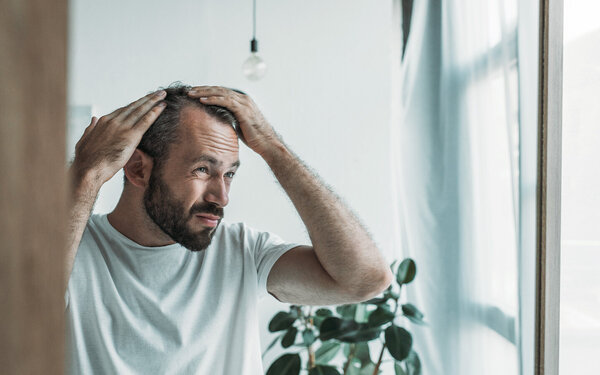 Mann mit Haarausfall checkt seine Geheimratsecken.