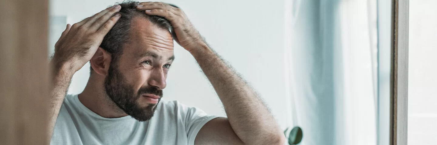 Mann mit Haarausfall checkt seine Geheimratsecken.