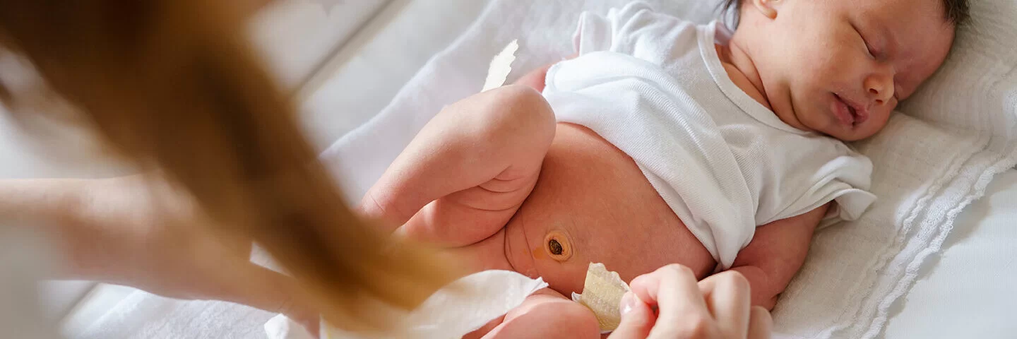 Die Wunde am Babybauchnabel braucht regelmäßige Nabelpflege, damit sie gut heilen kann.