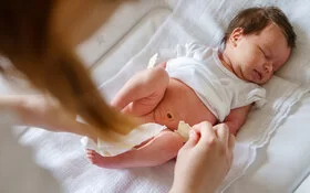 Die Wunde am Babybauchnabel braucht regelmäßige Nabelpflege, damit sie gut heilen kann.