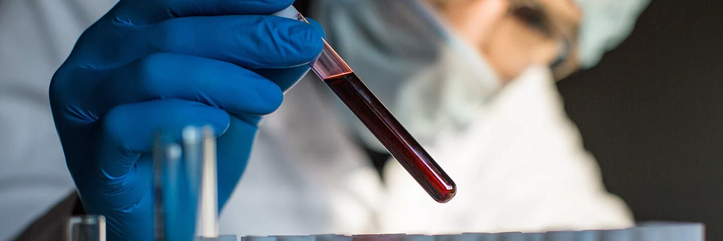 Ein Forscher hält ein Reagenzglas mit Blut in der Hand.