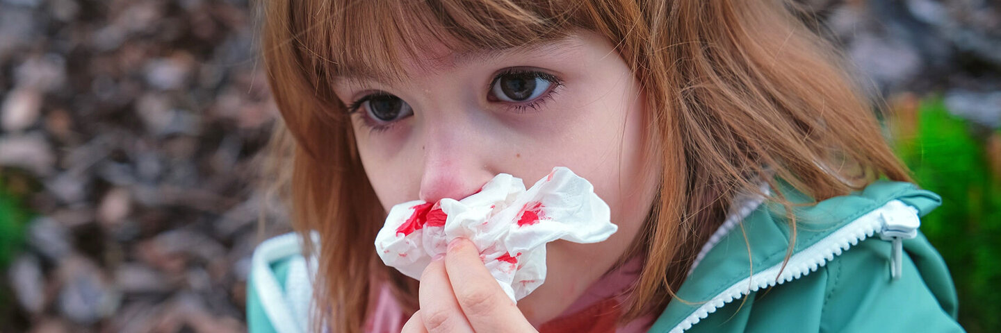 Eine Frau hilft einem Mädchen mit Nasenbluten