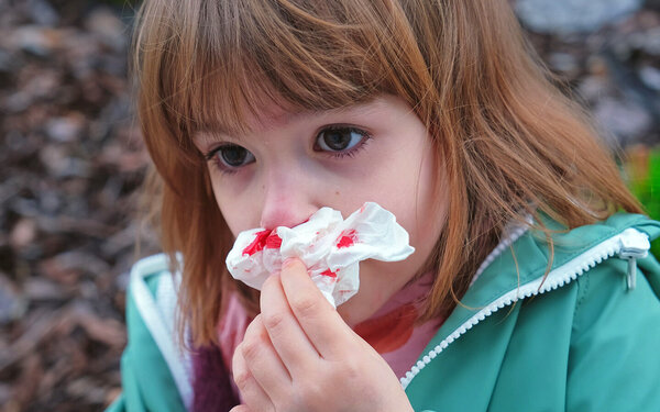 Eine Frau hilft einem Mädchen mit Nasenbluten