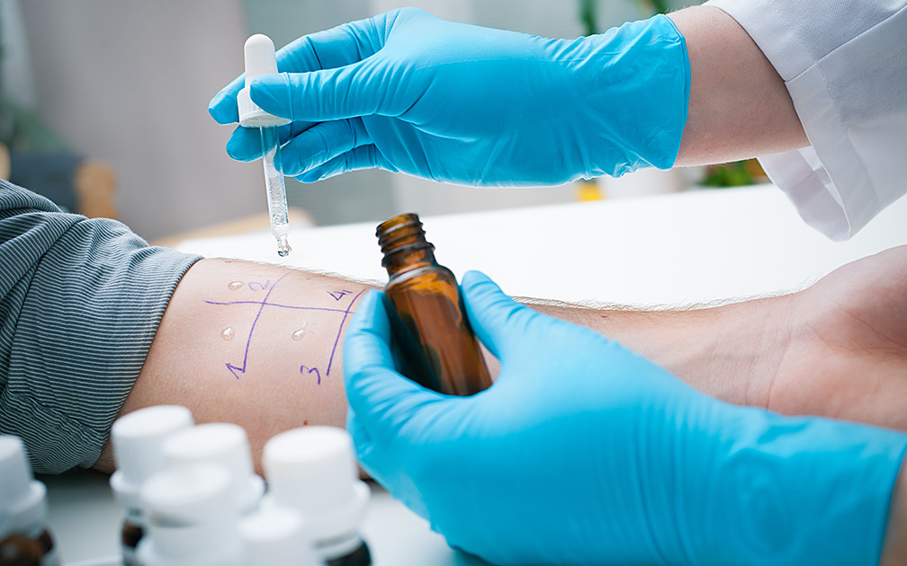 Hautausschlag von antibiotika amoxicillin