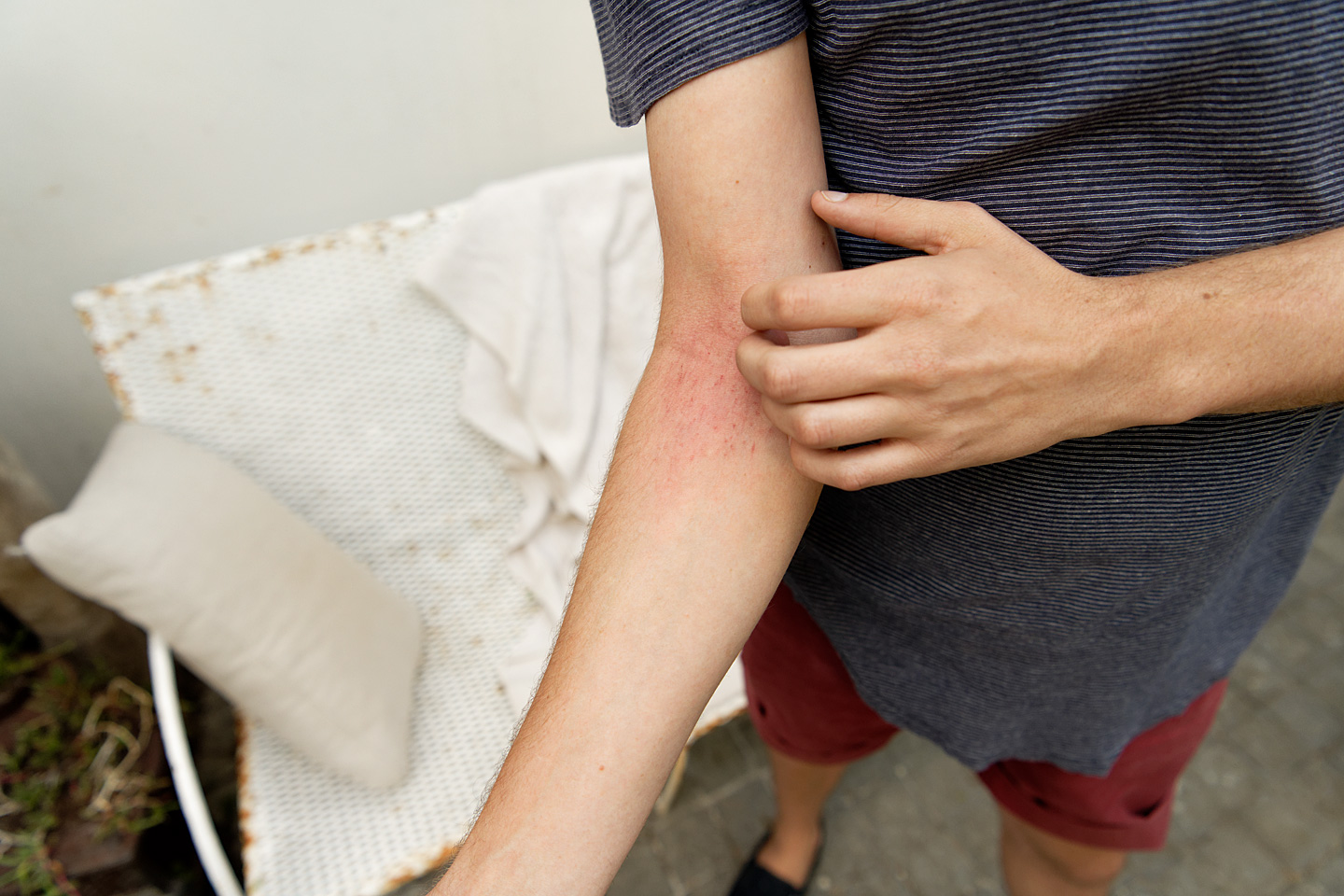 Kreuzallergie: Wenn zur Pollen- eine Nahrungsmittelallergie hinzukommt