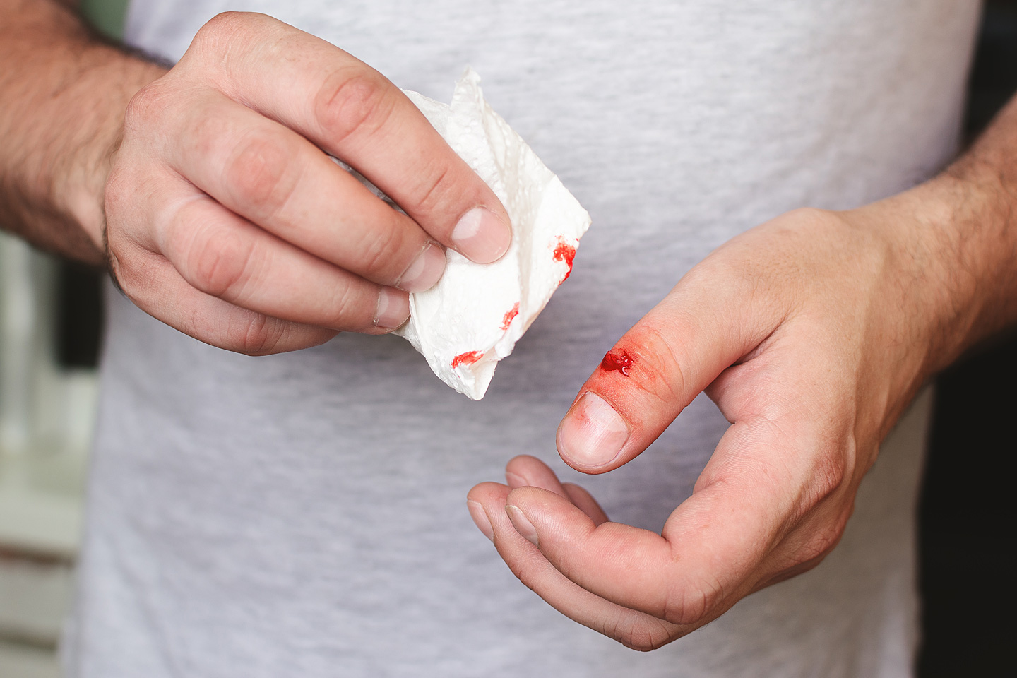 Mann mit Schnitt am Finger muss wegen Blutvergiftung in Behandlung.