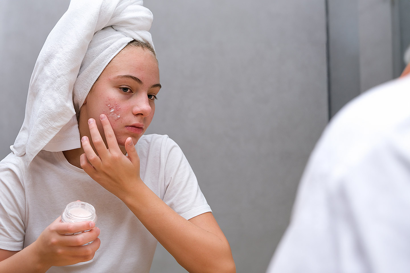 Aknenormin bestellen rezeptfrei