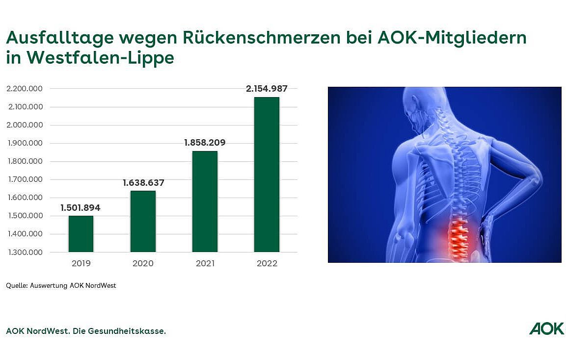 Die Grafik zeigt die Ausfalltage wegen Rückenschmerzen bei AOK-Mitgliedern in Westfalen-Lippe.