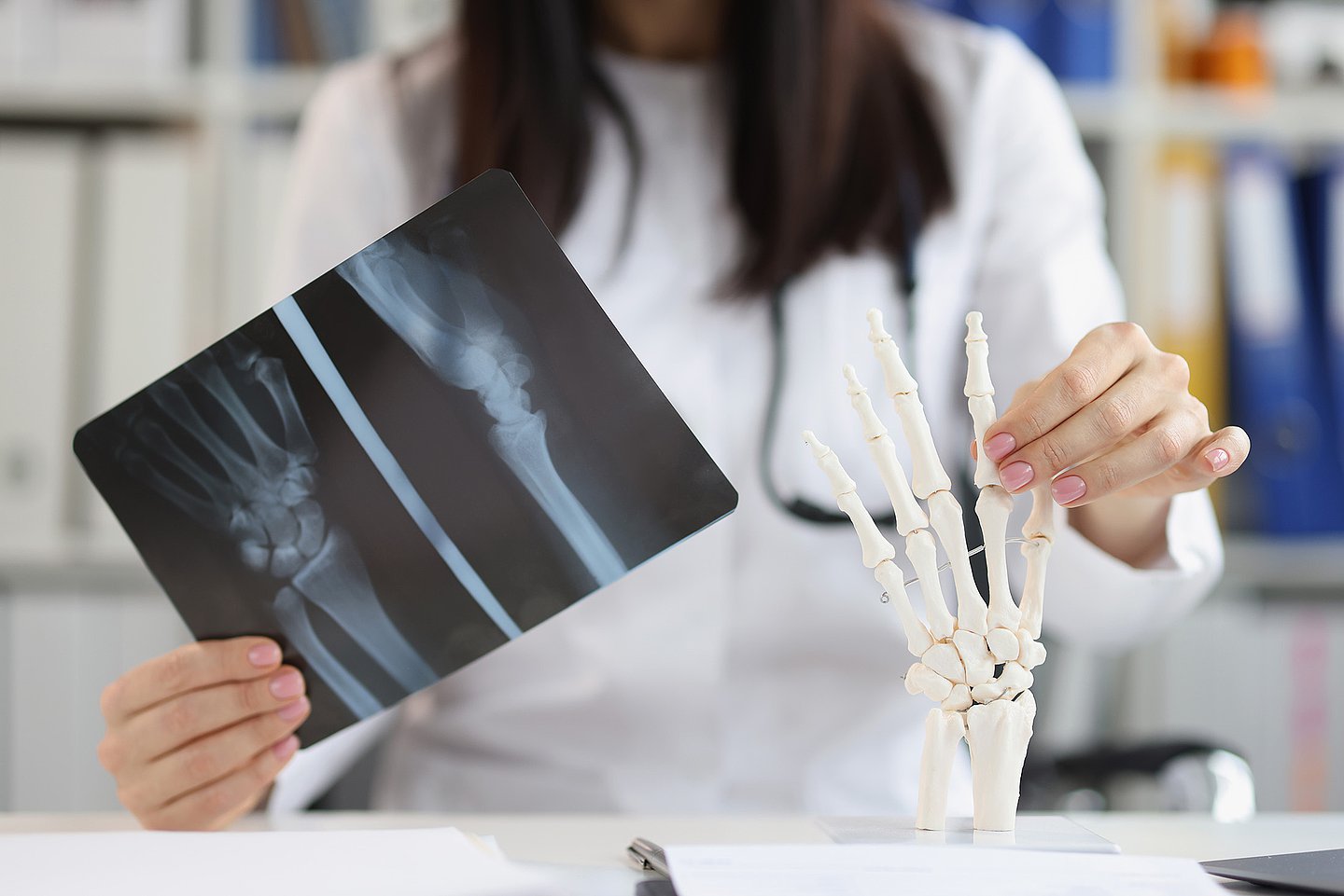 Eine Ärztin in Nahaufnahme schaut auf ein Röntgenbild, das Arthrose in den Fingergelenken zeigt.