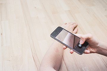 Mittels einer App wird ein Smartphone für ein Hautscreening benutzt.