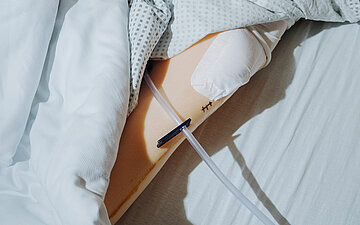 Foto eines Puppenarms im Krankenhausbett mit einer OP-Naht, die nicht korrekt abgedeckt ist