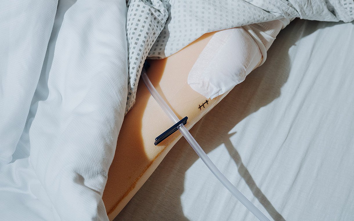 Foto eines Puppenarms im Krankenhausbett mit einer OP-Naht, die nicht korrekt abgedeckt ist