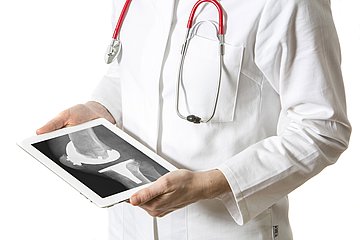Digitalisierung beim Arzt Ein Arzt hält ein Tablet mit einem Röntgenbild.