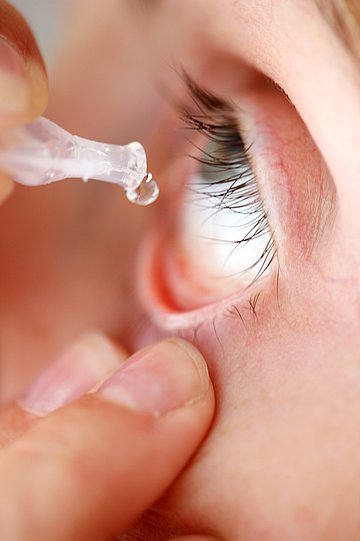 Typisches Symptom bei Heuschnupfen: gereizte, juckende Augen.