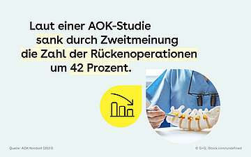 Infografik mit Wirbels&auml;ulenmodell und sinkendem Balkendiagramm: Laut einer AOK-Studie verringerte eine &auml;rztliche Zweitmeinung die Zahl der R&uuml;ckenoperationen um 42 Prozent.