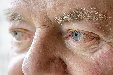 Innovative Pflegekonzepte sollen helfen, auch im Alter würdevoll zu leben.