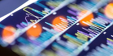 datengestützte Medizin Digitale Darstellung von farbigen Sequenzkurven, die übereinander liegen