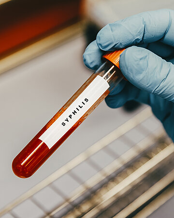 Eine Hand h&auml;lt ein Reagenzglas mit der Aufschrift "Syphilis".
