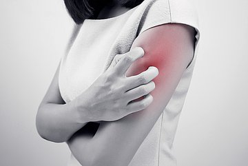 Seitlich von vorne links ist der Oberkörper einer Frau zu sehen, die sich intensiv mit der rechten Hand am linken Oberarm kratzt, der bereits eine rötliche Färbung zeigt.