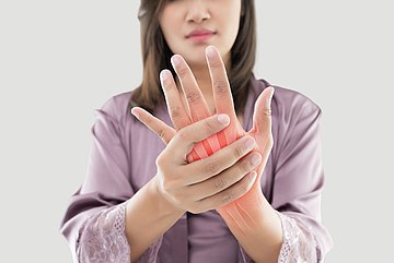 DMP Rheumatoide Arthritis in Schleswig-Holstein Eine Frau hält sich mit der rechten die schmerzende linke Hand.