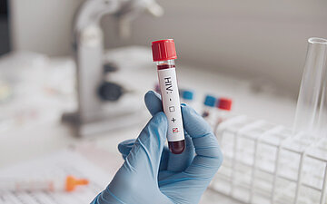 Foto: Eine Hand h&auml;lt im Labor eine Blutprobe mit der Aufschrift HIV hoch.