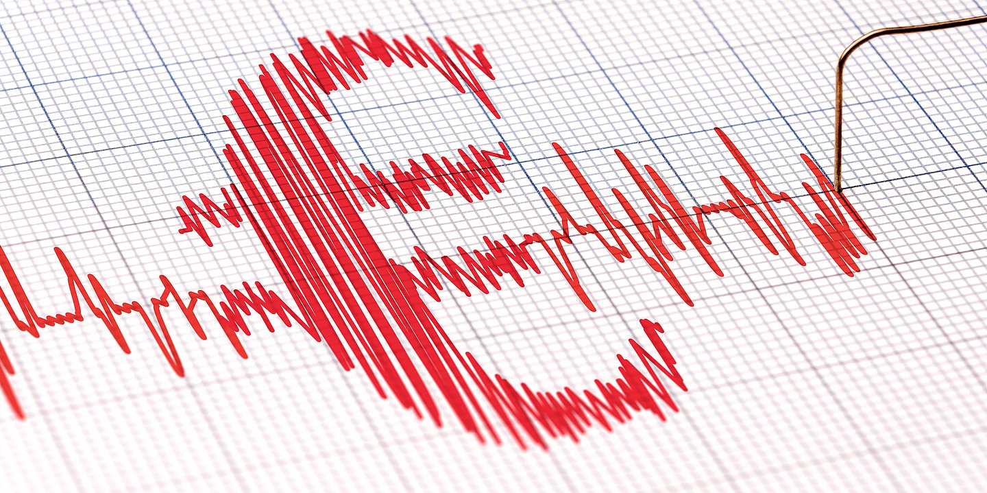 Die Illustration zeigt eine EKG-Kurve, die ein Euro-Zeichen bildet.