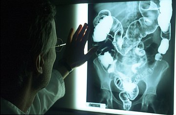 Ein Radiologe wertet ein Röntgenbild aus.