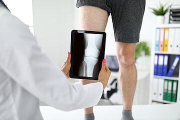 Ein Arzt h&auml;lt die R&ouml;ntgenaufnahme eines Knies auf einem Tablet vor das Knie des Patienten, der vor ihm steht.