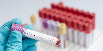 Foto: Eine Hand mit einem Einmalhandschuh h&auml;lt ein Blutr&ouml;hrchen mit der Aufschrift "HIV", dahinter stehen eine Reihe von anderen Blutr&ouml;hrchen.
