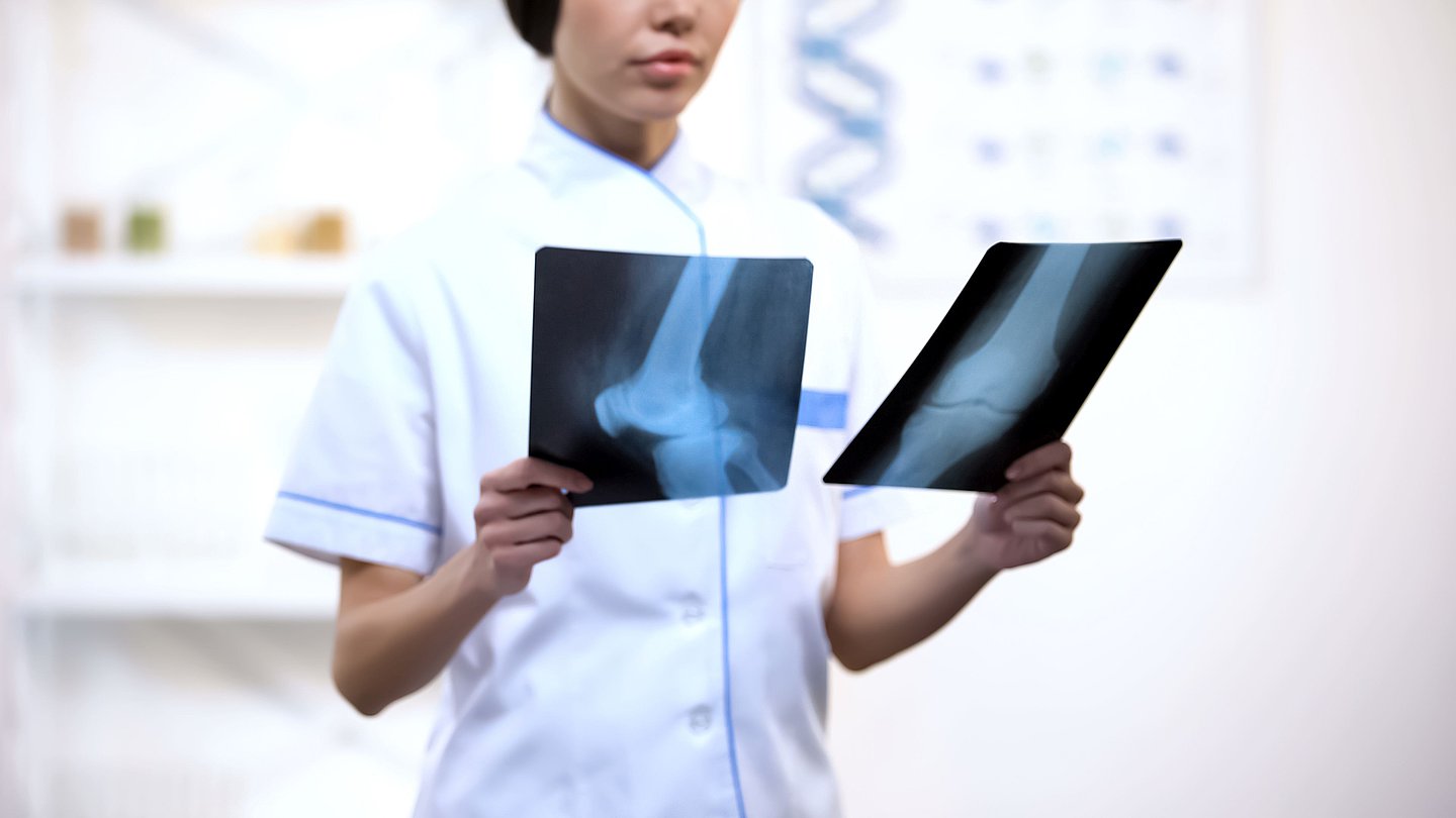 Foto einer Ärztin, die sich Röntgenbilder eines Kniegelenks ansieht.