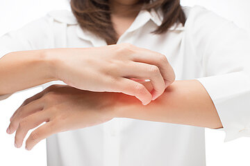 Eine Frau, ohne Gesicht, nur mit dem Oberk&ouml;rper sichtbar, h&auml;lt beide H&auml;nde mit Abstand vor ihren Oberk&ouml;rper und kratzt sich intensiv mit ihrer rechten Hand am linken Unterarm.