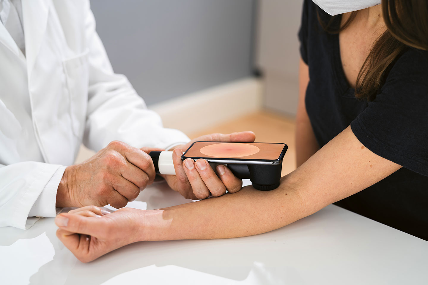 Foto: Ein Arzt untersucht einen Leberfleck bei einer Frau mittels Hautkrebsscreening.