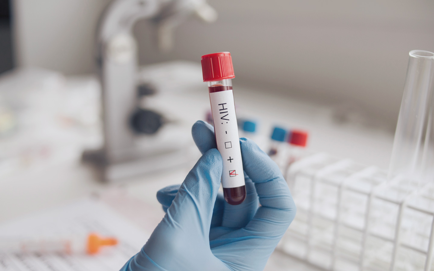 Foto: Eine Hand hält im Labor eine Blutprobe mit der Aufschrift HIV hoch.